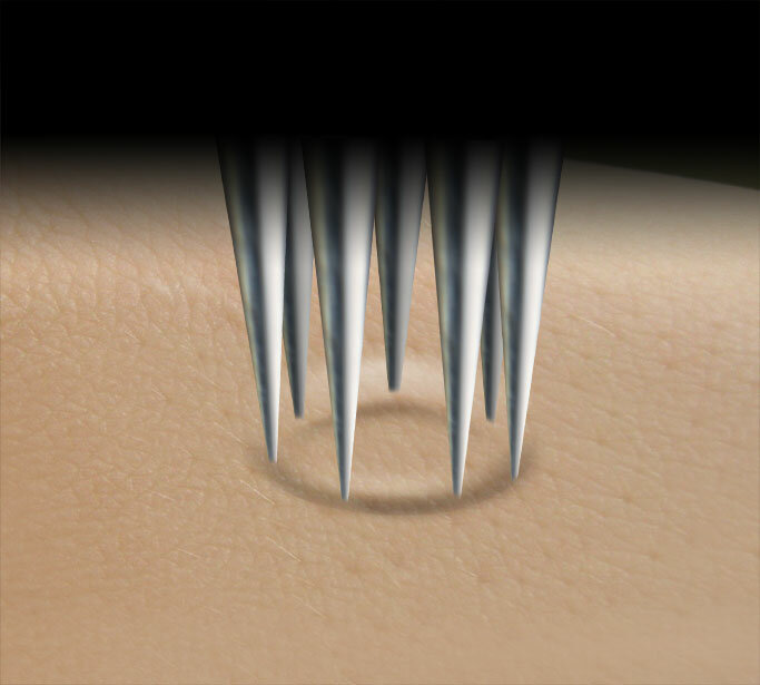 7er Turbo Round Liner - 0.35 mm - Kwadron