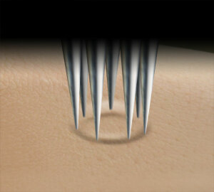 11er Turbo Round Liner - 0.35 mm - Kwadron